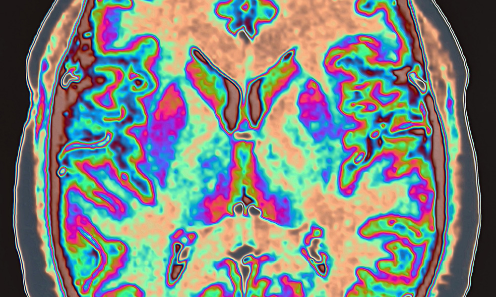 Brain scan technology image