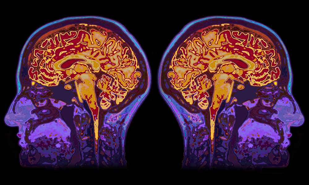 Brain scan shows biomedical optics at work