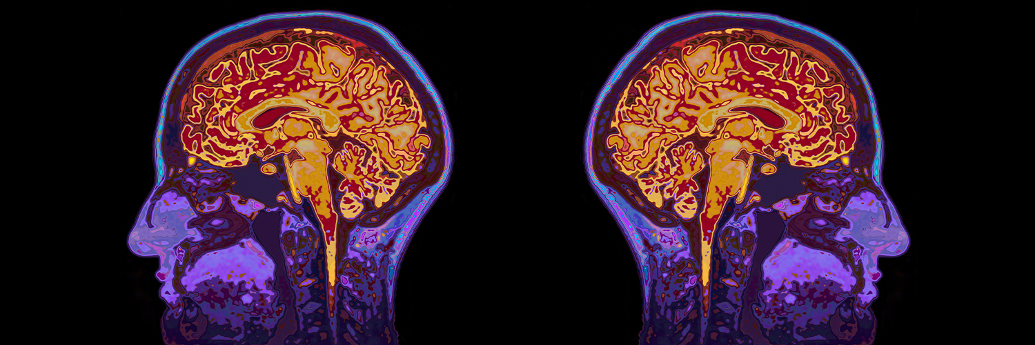 Brain scans in purple and orange