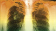Attend SPIE/OSA European Conferences in Biomedical Optics