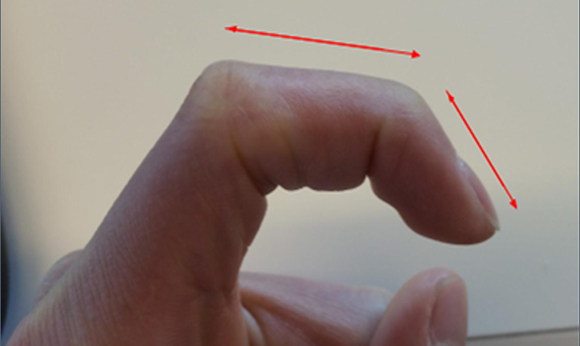 Robotic grippers in Ounaies' lab were inspired by the notches in a human finger. Credit: S. Ahmed, et al. doi.org/10.1117/12.2514902.