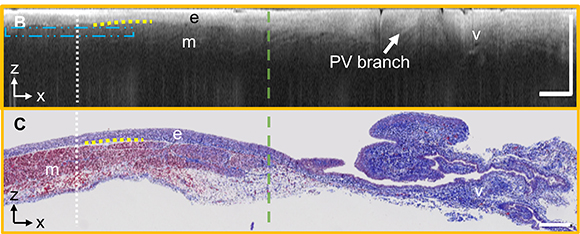 OCT image and histology