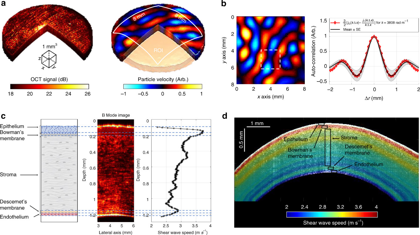 OCE combines optical and mechanical data to assist with diagnoses