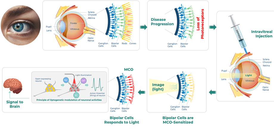 Nanoscope’s MCO optogenetics therapy for vision restoration