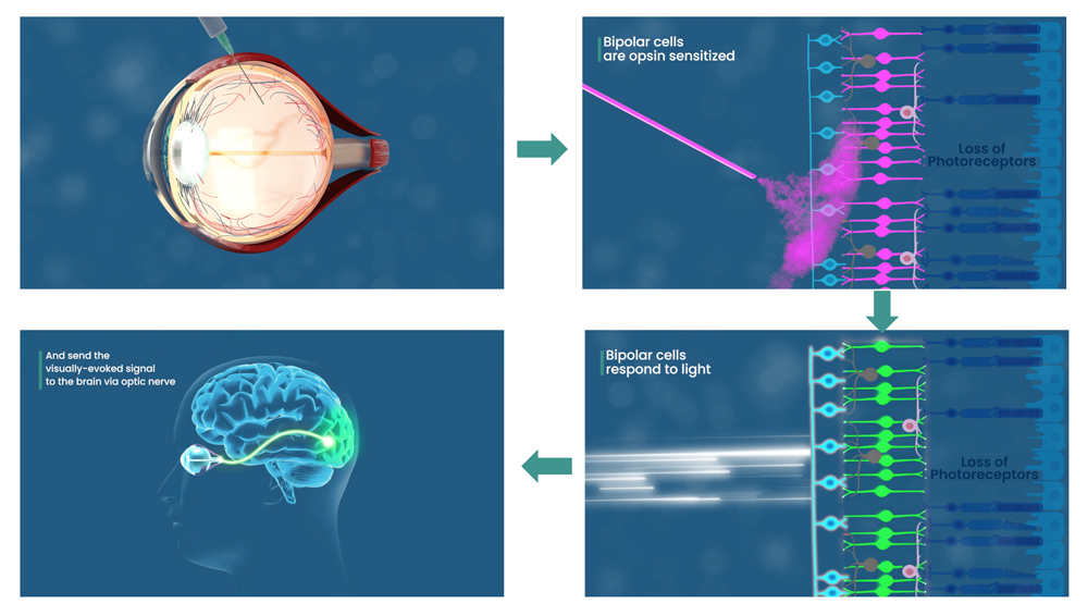 Optogenetic approach does not require the use of any intensifying goggles