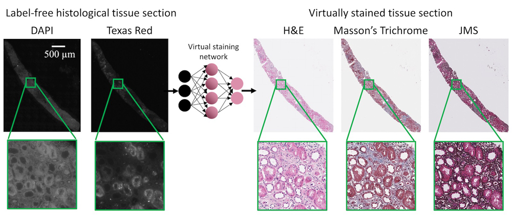 Virtual staining