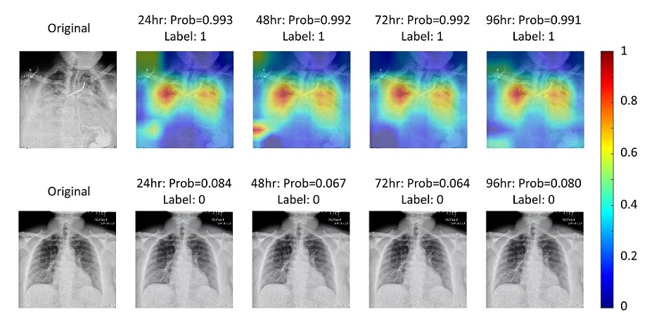 The proposed deep learning model utilizes chest x-ray radiography images