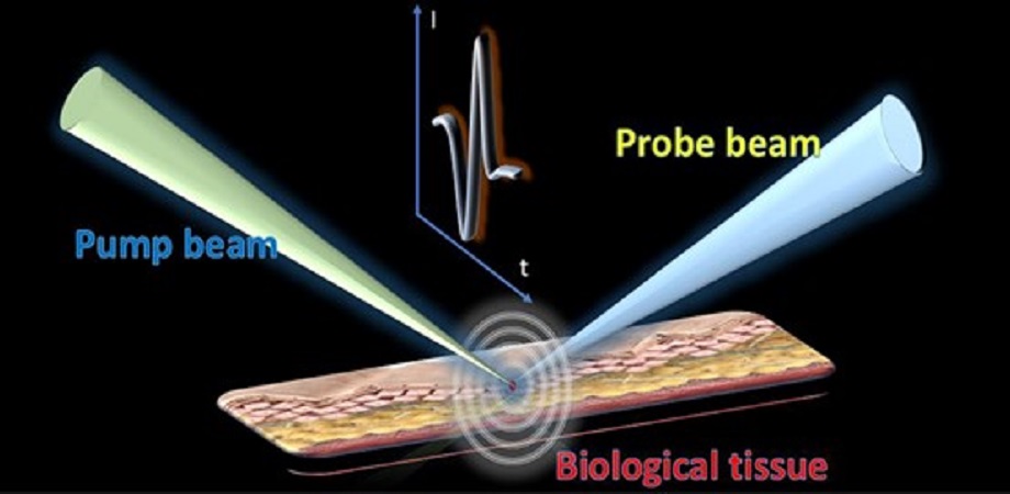 Mechanism of photoacoustic remote sensing