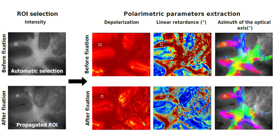 Comparing polarimetric properties of fresh and preserved brain tissue