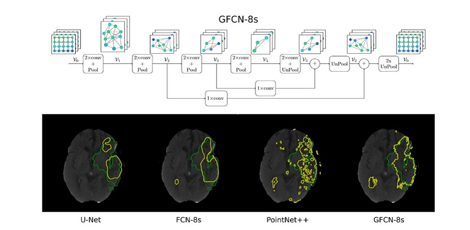 GFCN-8s, a proposed geometric deep learning network