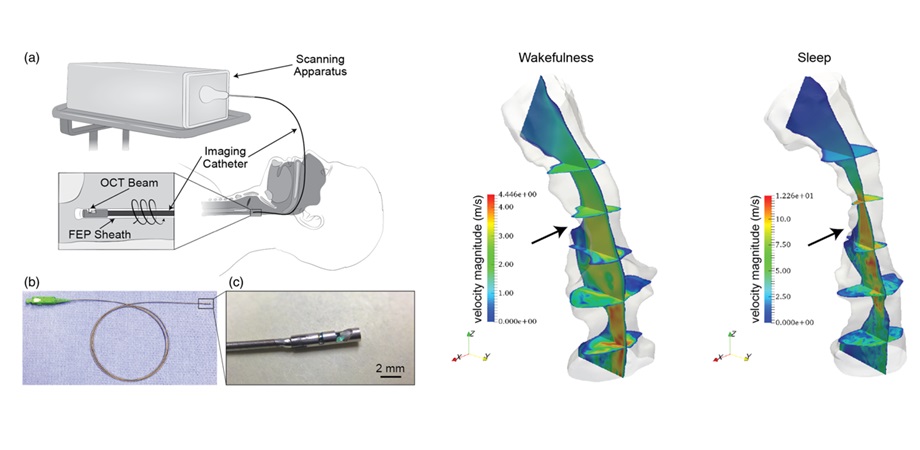 High-fidelity structural information and airflow data of a sleeping patient’s upper airway