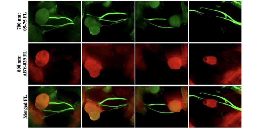 Two-color fluorescence nerve and tumor visualization