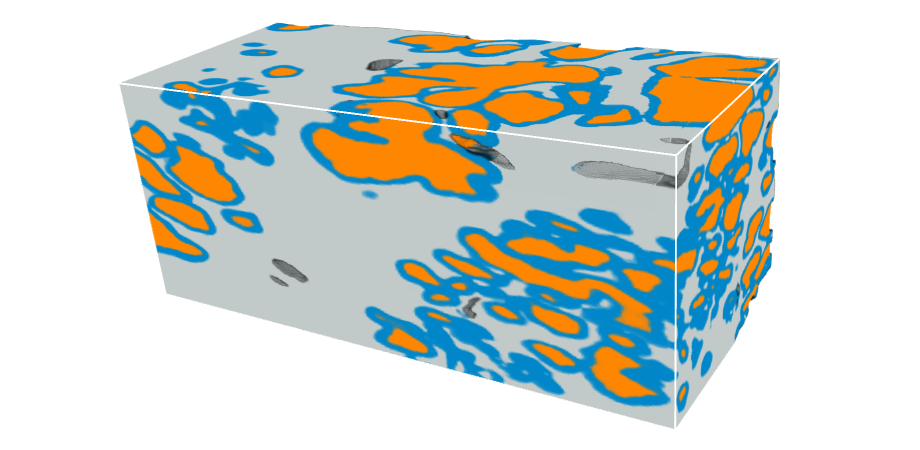 Microscopic glands of the prostate are segmented (colored) with the new deep-learning pipeline