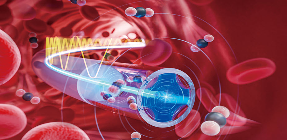 Fiber photoacoustic spectrometer enables continuous intravascular gas monitoring