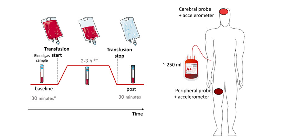 Hybrid diffuse optics enables probes for monitoring blood transfusion