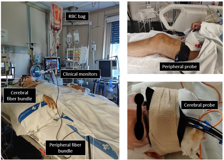 Intensive care unit setting and probe placement.