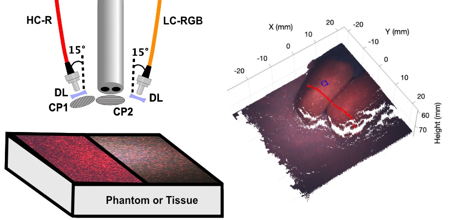 Detailed optical property maps of biological tissues result from a newly developed laparoscopic imaging device that integrates stereo depth estimation and speckle-illumination spatial frequency domain imaging