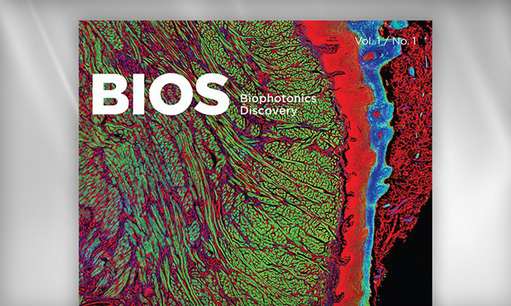 SPIE journal Biophotonics Discovery cover