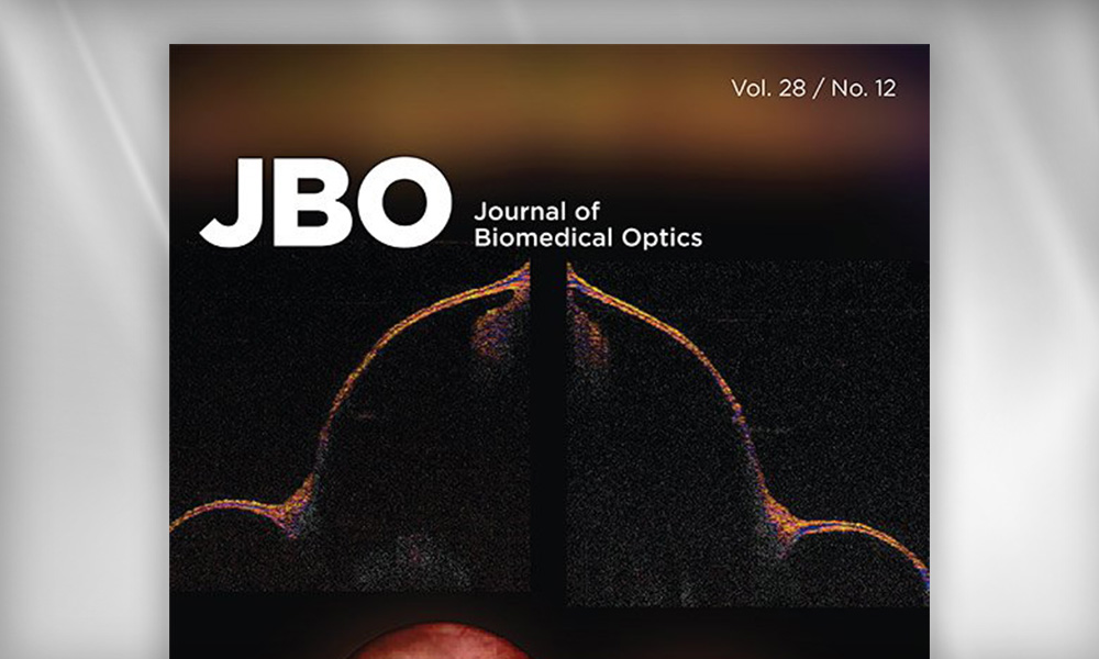 SPIE Journal of Biomedical Optics cover