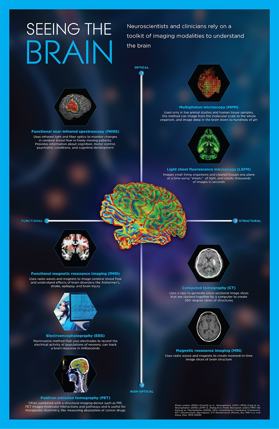 Seeing the brain infographic