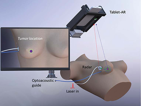 optoacoustic guide system